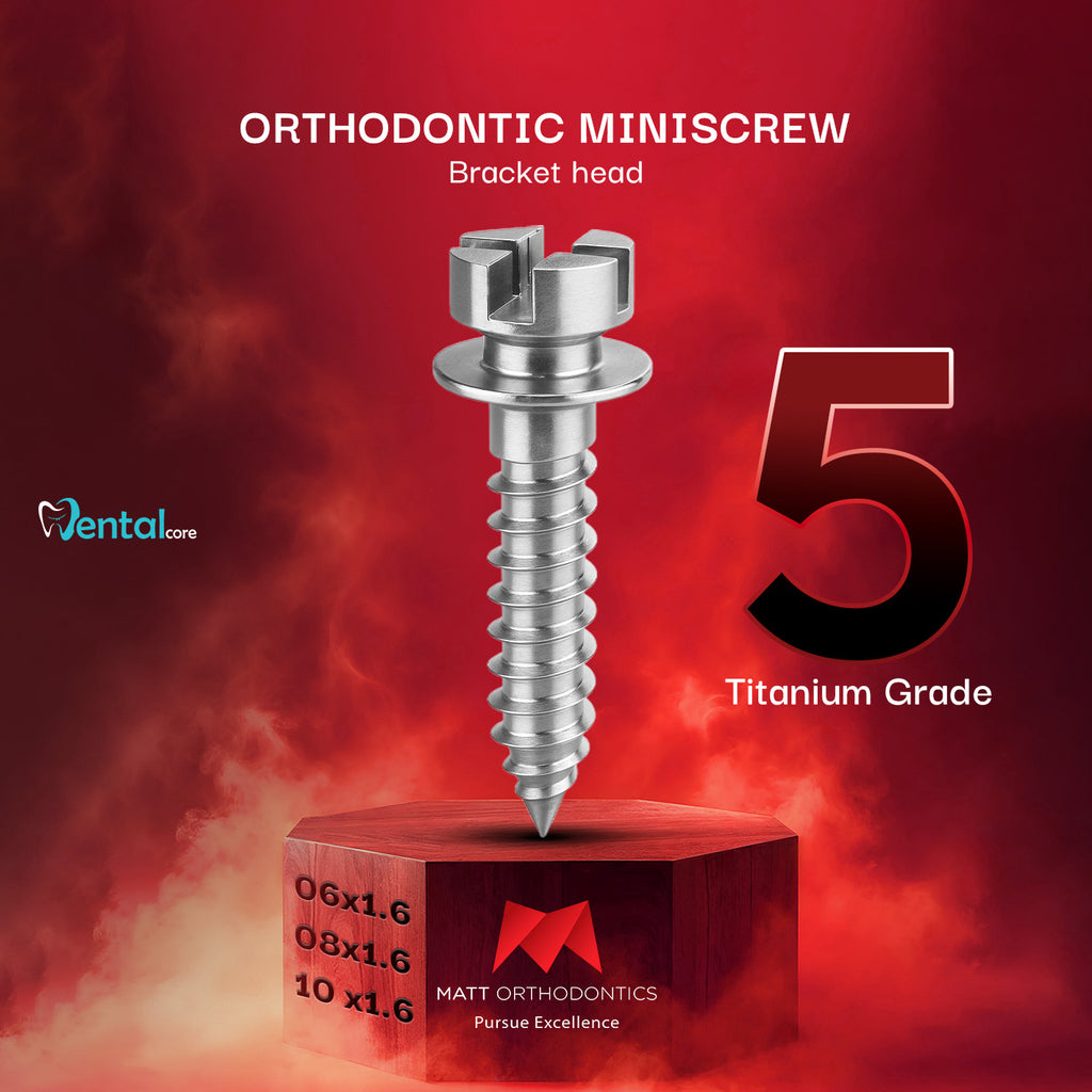 Miniscrews Matt Orthodontics