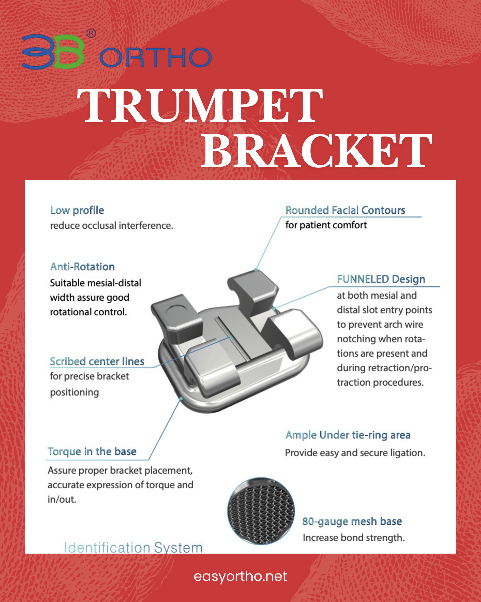 3b mini bracket trumpet edition